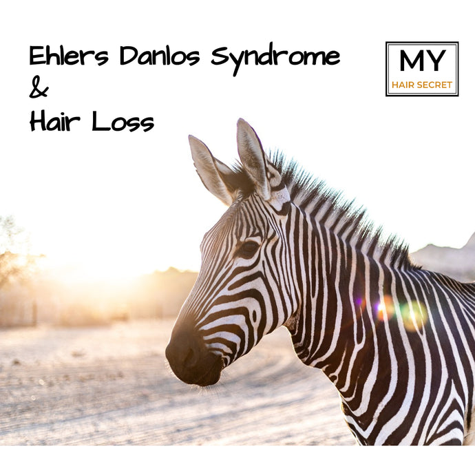 Ehlers-Danlos Syndrome and Hair Loss: : A Holistic Approach to Hair Care